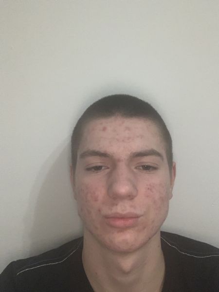 Profilbillede